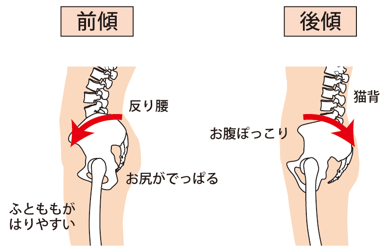 お腹ぽっこり02